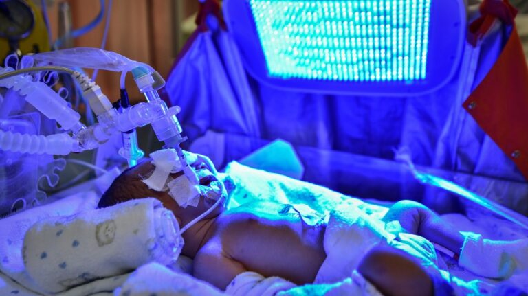 Sick baby with neonatal jaundice and hyperbilirubinemia under blue UV light