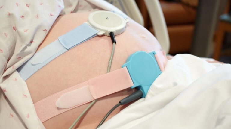 electronic fetal monitor sensors on a pregnant woman's abdomen