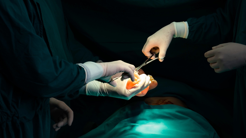 Doctor surgery team in the operating room of abdominal cesarean section during child birth