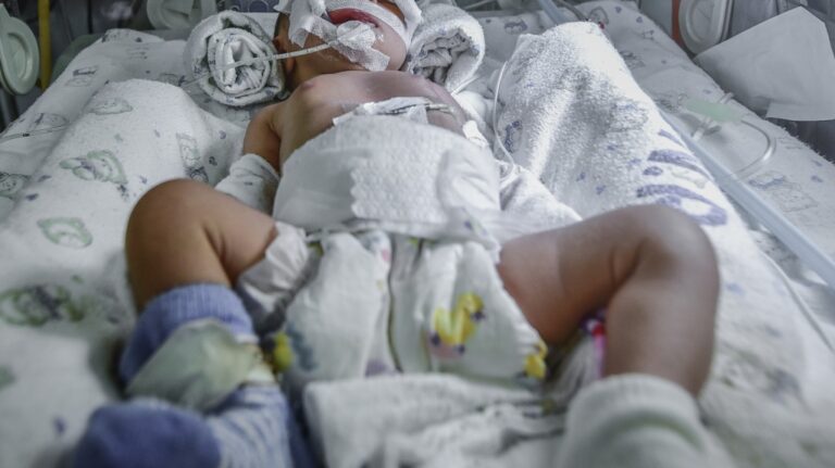 Sick newborn baby on breathing machine