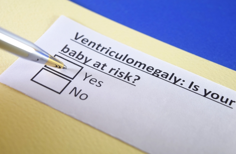 Ventriculomegaly: is your baby at risk