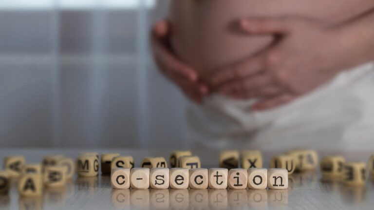 Word C-SECTION composed of wooden letters